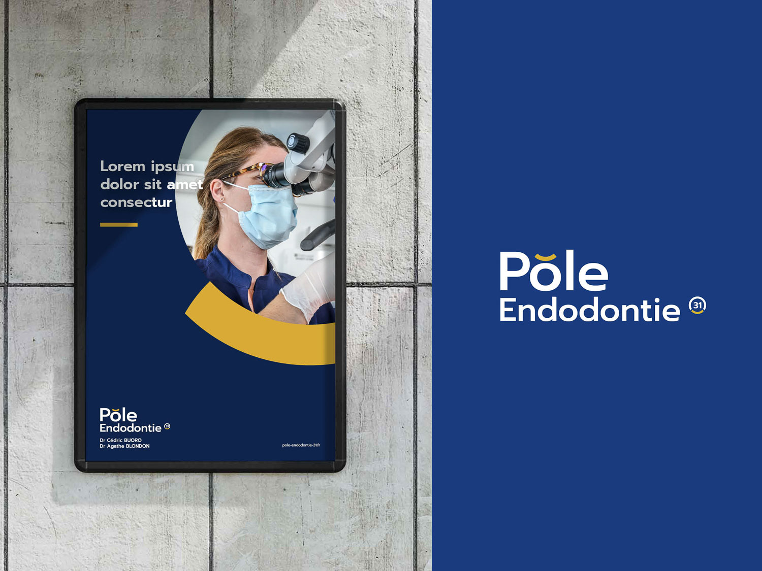 pole endodontie 31 mock up12